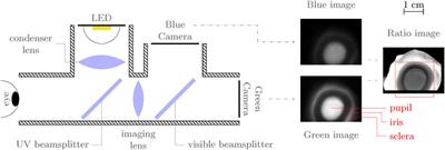 Fluorescence imaging for the anterior segment of the eye